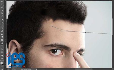 21.3-Step2-Forehead